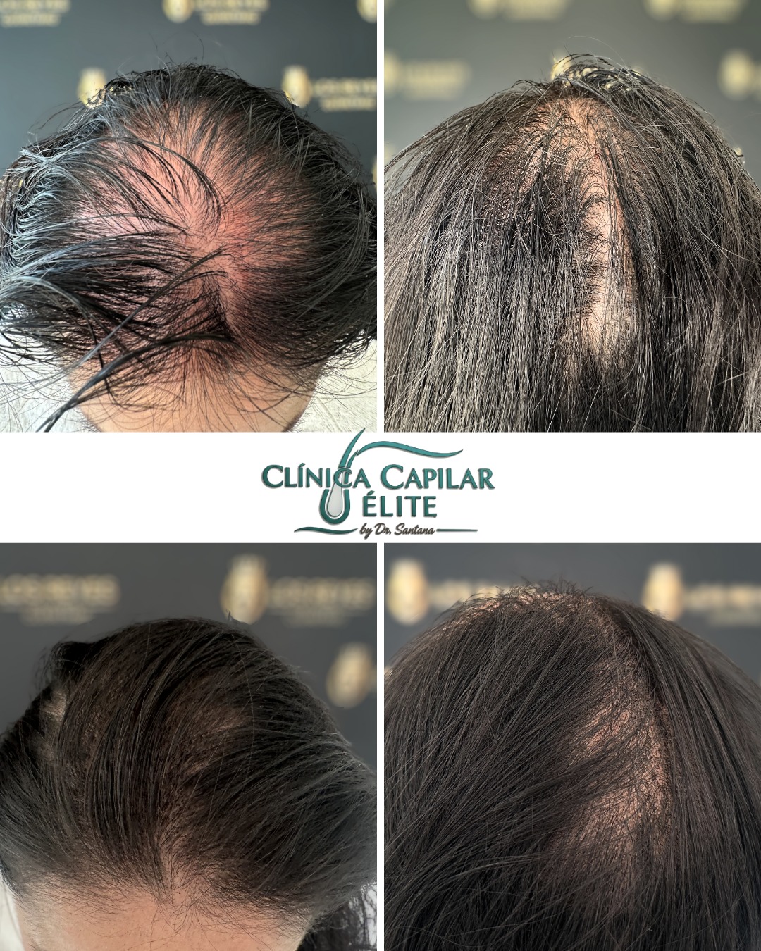 Diagnóstico Capilar