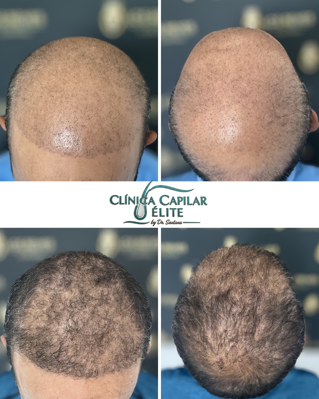 Diagnóstico Capilar