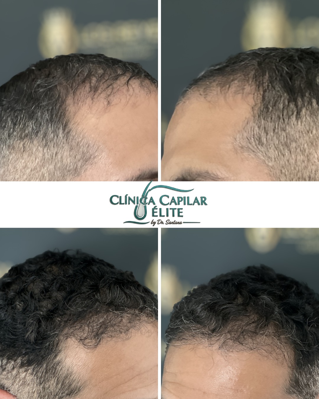 Diagnóstico Capilar