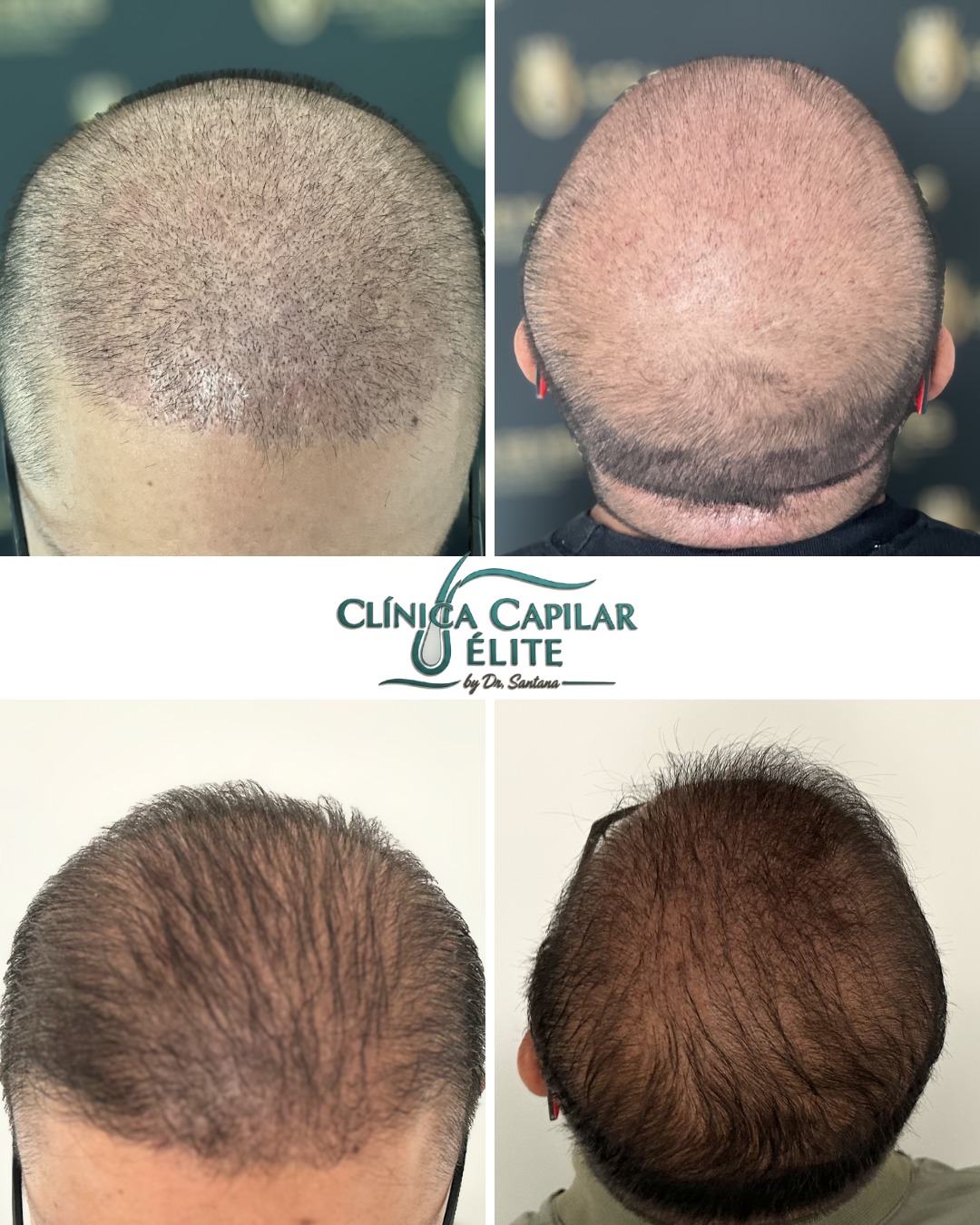 Diagnóstico Capilar